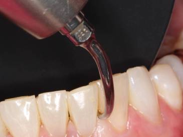 Shire Perio Academy Precision Periodontal Therapy Module 1 RS